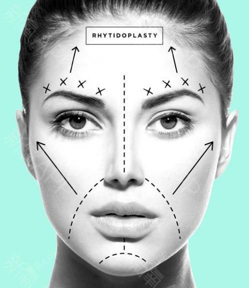 9组唯美的整形项目示意图,教你更深刻认知整形!