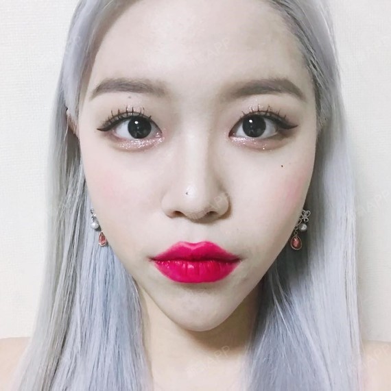 【苏州美贝尔●精塑迷人翘下巴】下巴真的是越来越自然_圈子-新氧美容