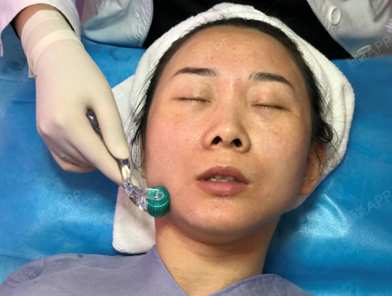 手打的丝丽,水光补水,滚针,一套做下来脸有点火辣辣的  刚做完见不到