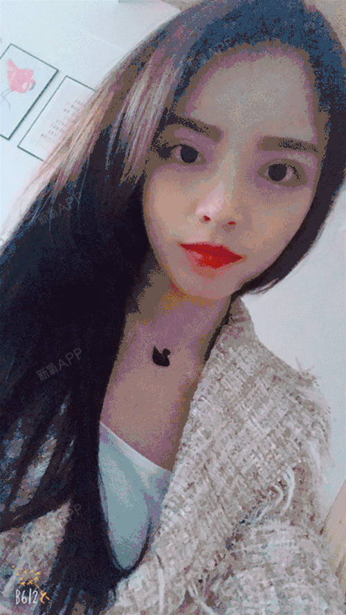 【苏州美莱双眼皮术后第43天】今天已经一个多月啦,_圈子-新氧美容