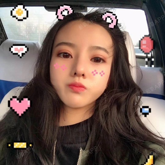 又消了好多,鼻子越来越小巧玲珑了,哈哈,开心,眼睛_圈子-新氧美容整形