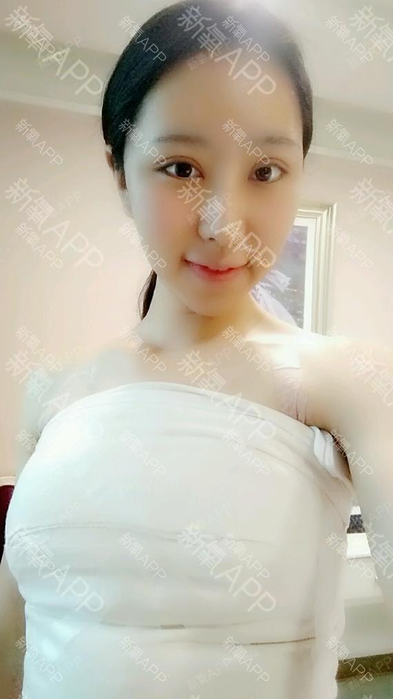 新氧- 氧气9409641521535176 | 胸部 | 隆胸 | 假体隆胸 | 术后当自强