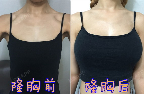 一样的衣服 穿出来不同效果