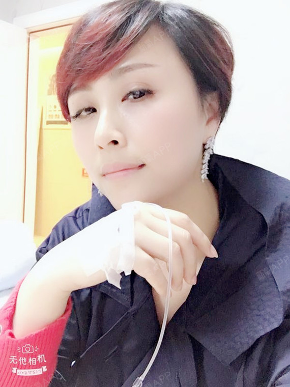 做到最好的约定自体脂肪隆胸第3天美丽日记