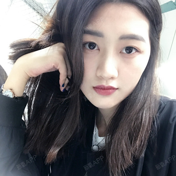 武汉自体脂肪全脸填充好不好_效果图_小小小谢自体脂肪全脸填充术后第