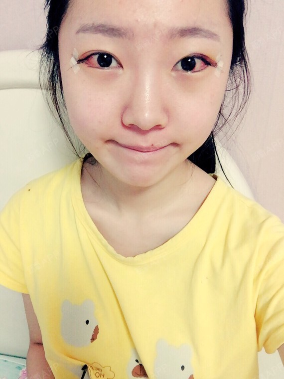 一直都觉得我是典型的吊吊眼的代表,尤其是侧面看的时候,眼神犀利的能