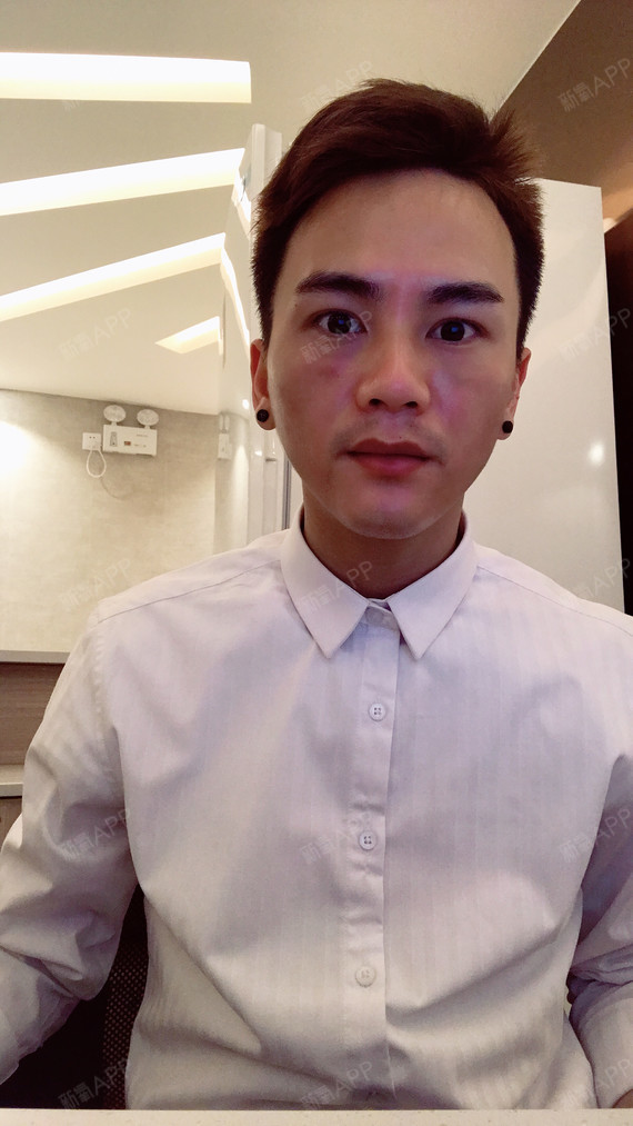 陈晨a玻尿酸丰泪沟第1天美丽日记