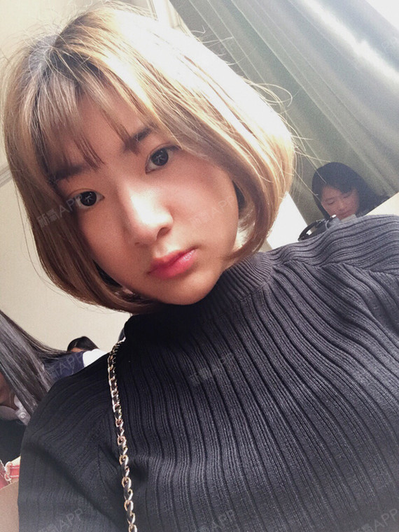 眼部多项好不好_效果图_小圆的圆眼部多项术后第139天_新氧美容整形