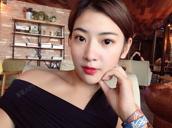 眼部多项好不好_效果图_小圆的圆眼部多项术后第139天_新氧美容整形