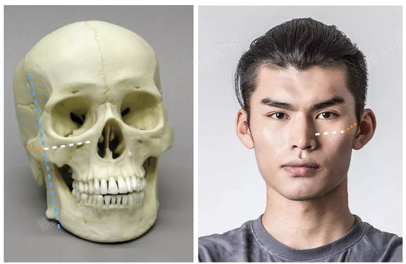 亚洲人头骨和亚洲人脸型