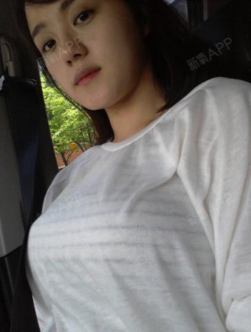 目前是我术后一个多月的胸部了,胸部柔软了很多,我现_圈子-新氧美容