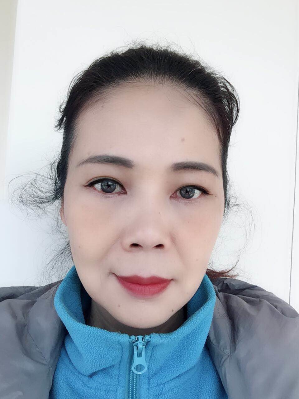 【提眉 祛眼袋术后第109天】效果现在是越来越好._圈子-新氧美容整形