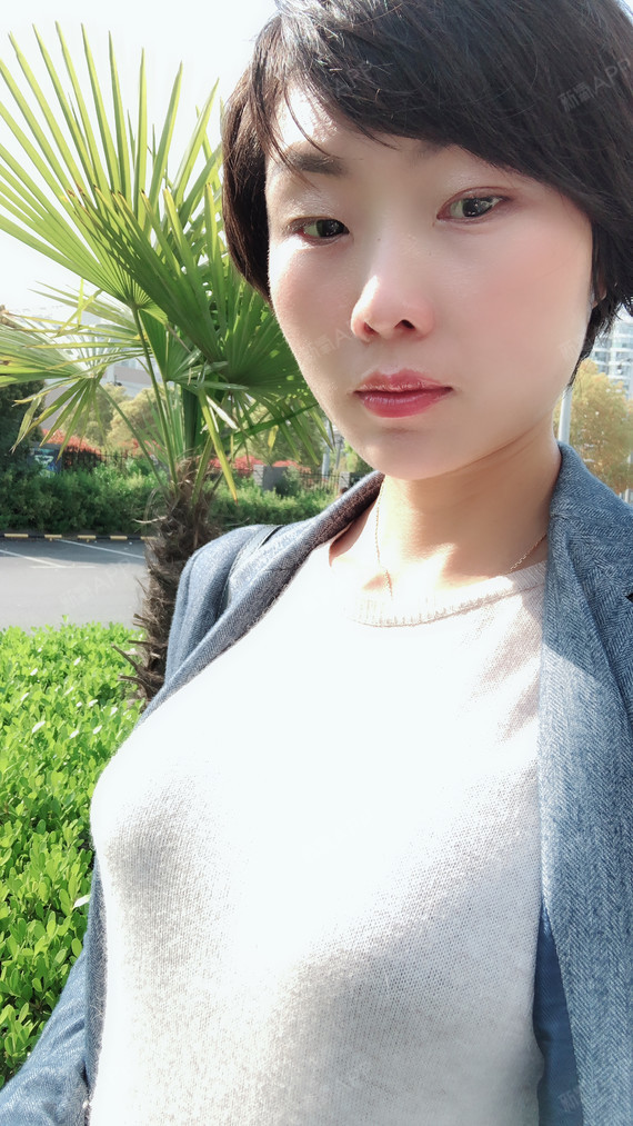 假体隆胸好不好_效果图_金牛座宋美娟假体隆胸术后第25天_新氧美容