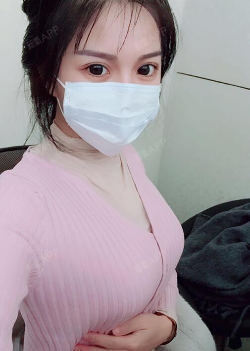 昨天晚上拍的照片,哈哈哈~      胸部恢复50天了,效果可以说是非常