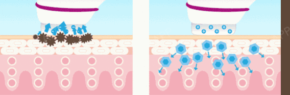打水光补水真的很疼吗?王洋医生给宝宝们科普一下