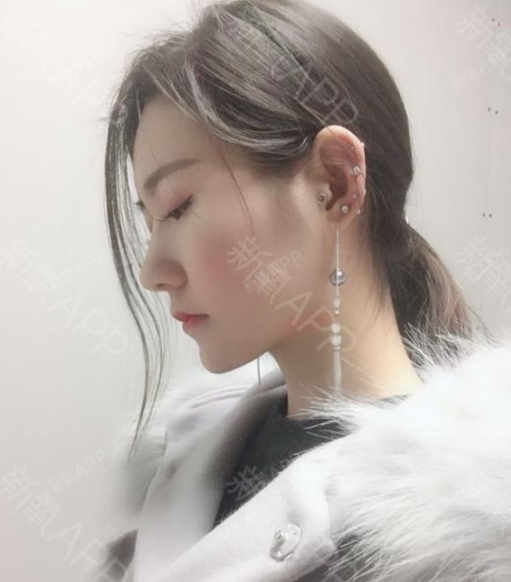 以后如果打算做假体的话会考虑_圈子-新氧美容整形