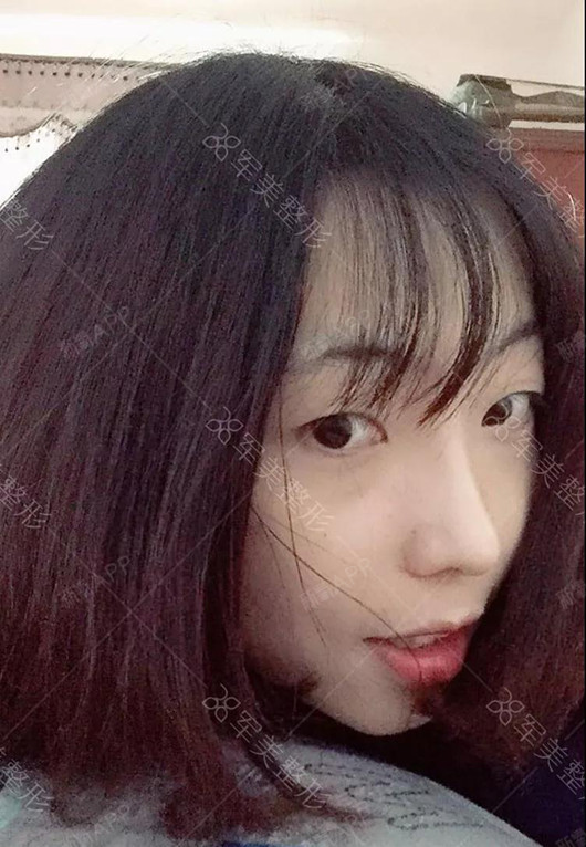 又短又塌的鼻子拉低颜值,翘挺自然的鼻子加分多少?