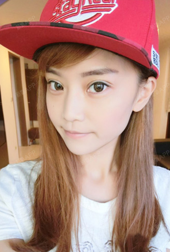 之前眼睛的感觉圆,哭过容易肿,做过双眼皮6个月之后_圈子-新氧美容