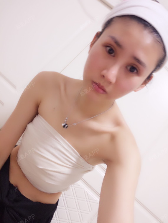 假体隆胸好不好_效果图_饶人饶人若假体隆胸术后第2天_新氧美容整形