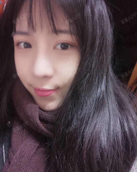 鼻部多项好不好_效果图_曦萌鼻部多项术后第135天_新氧美容整形