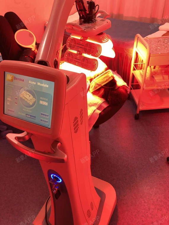 第一次做医美的治疗,皮肤有点敏感,就做了红光治疗,感觉效果还