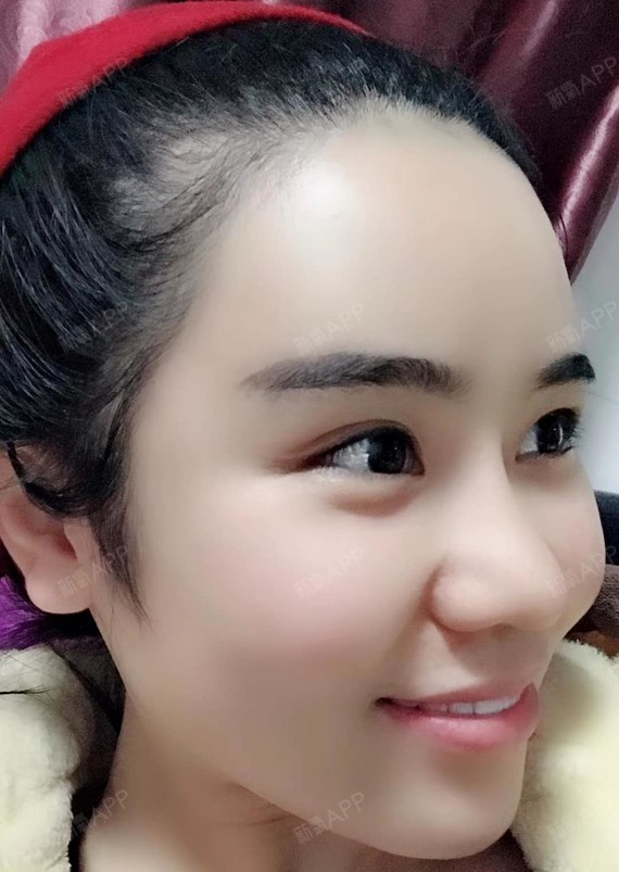 经常用手去摸额头,就_圈子-新氧美容整形