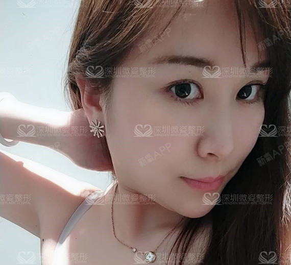 #俊俏小脸如何打造#脸型的改变对每一个爱美
