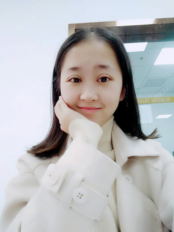 宜昌眼部综合好不好_效果图_韩小梅梅眼部综合术后第5天_新氧美容整形