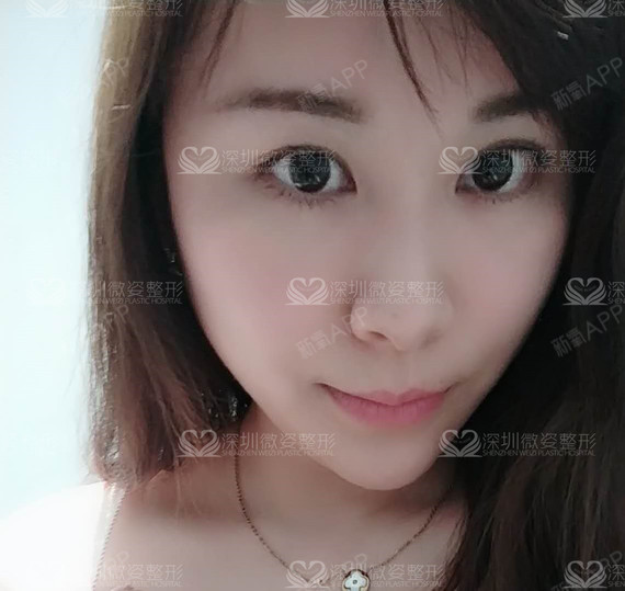 #俊俏小脸如何打造#脸型的改变对每一个爱美