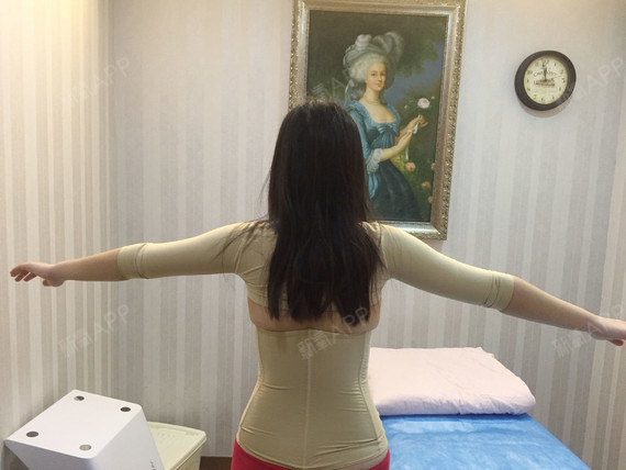 大家都管那种很粗的胳膊叫"麒麟臂""妈妈臂"吧,很_圈子-新氧美容整形