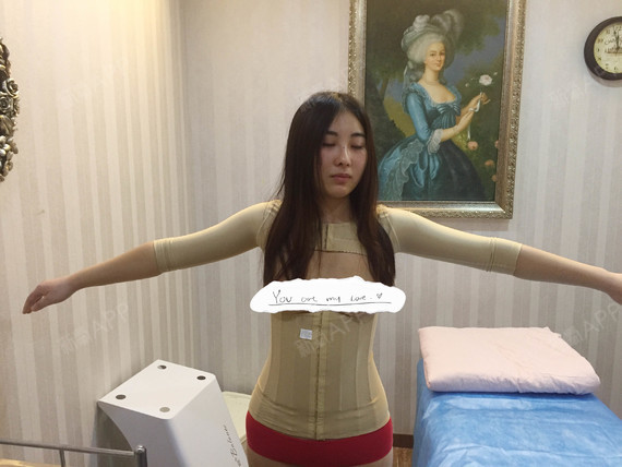 大家都管那种很粗的胳膊叫"麒麟臂""妈妈臂"吧,很_圈子-新氧美容整形