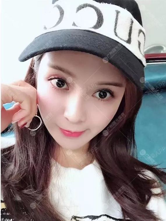 你平淡无奇清汤寡水的脸蛋就不要配这种双眼皮了,割了也不会让你的