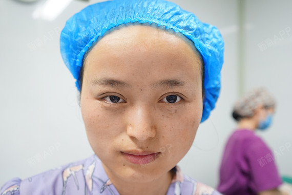 新鲜出炉的双眼皮,来给大家瞧瞧.