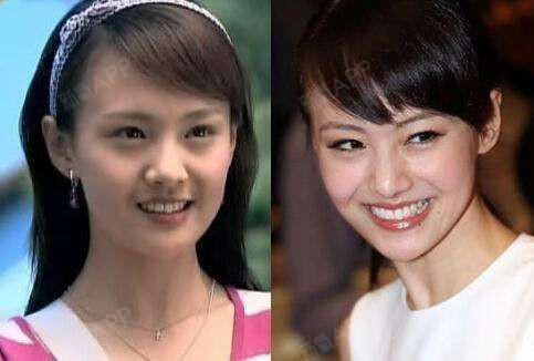 【周冬雨动双眼皮,范冰冰动眼角,女星们的大美眼怎么_圈子-新氧美容