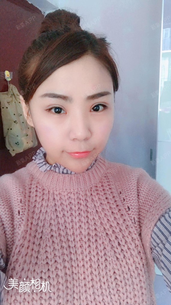 氧气2192261504665396 | 眼部 | 术后当自强 | 上海同城 | 眼部综合