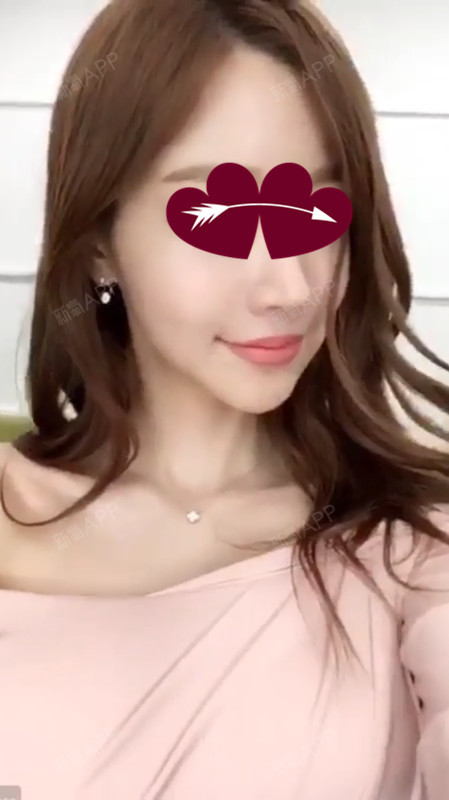 上海手术紧缩阴道好不好_效果图_氧气vume773手术紧缩阴道术后第5天