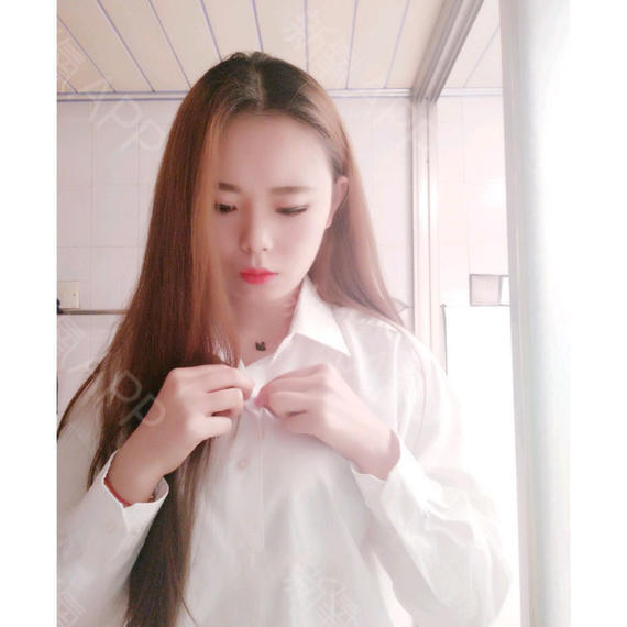 合集·假体隆胸共3篇编辑于2018年5月现在明显的感觉自己的胸变得很大