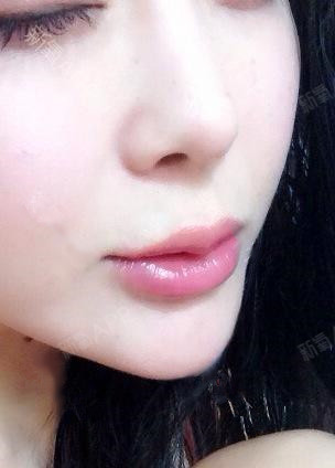 特别喜欢上唇的形状,唇峰唇珠本明显,但是又不会太夸_圈子-新氧美容