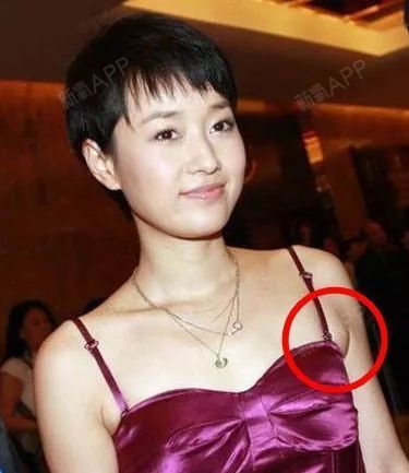 马伊琍的副乳胸大的有副乳,胸小的也逃不过.