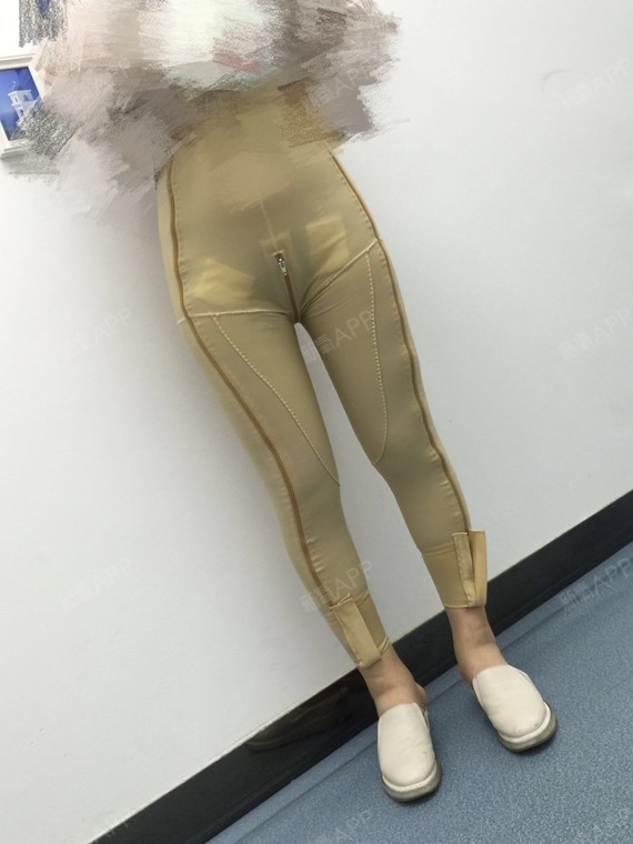 新氧- 氧气1021821525267748 | 美体塑形 | 吸脂瘦大腿 | 吸脂瘦小腿