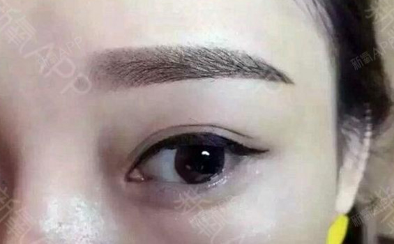 半永久纹眉项目术后第8天        我的眉毛已经在慢慢恢复了