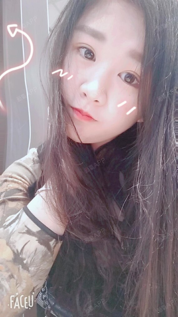 北京隐形矫正好不好_效果图_浆果儿隐形矫正术后第36天_新氧美容整形