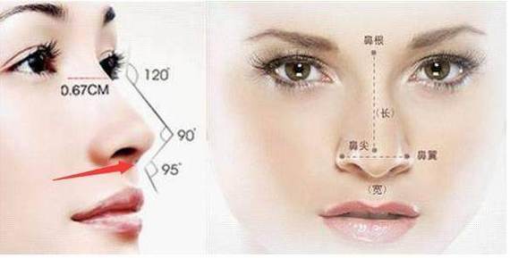【杭州美莱高士乾】鼻基底的位置在哪?什么的鼻子需要做鼻基底手术?