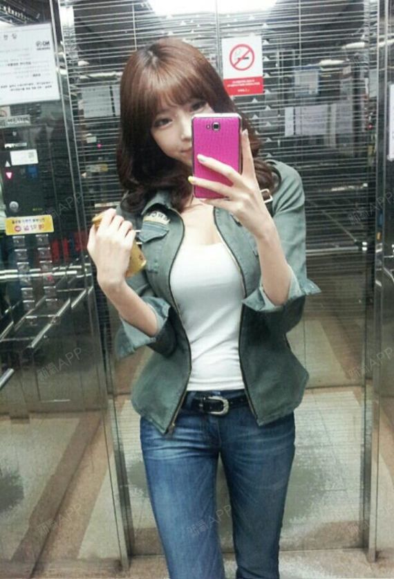 自体脂肪隆胸好不好_效果图_氧气jupc99e自体脂肪隆胸术后第140天