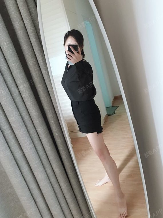 吸脂瘦手臂好不好_效果图_彭逸兹旧颜吸脂瘦手臂术后第35天_新氧美容