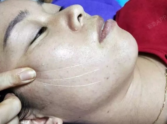 无针线雕效果真的如其说的那么好吗?