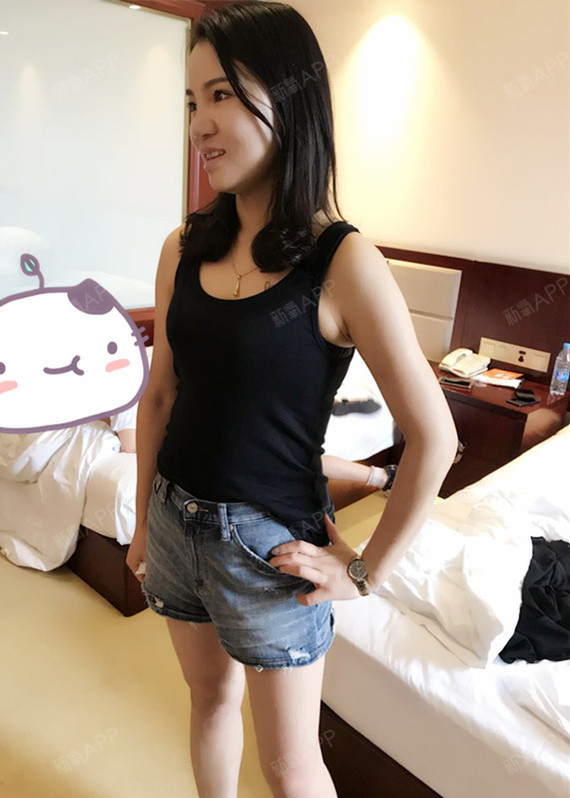 fydyfh吸脂瘦腰部第25天美丽日记