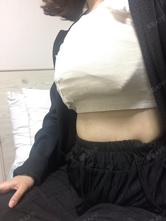 手术结束后醒来,缠着绷带,现在还无法亲眼确认.