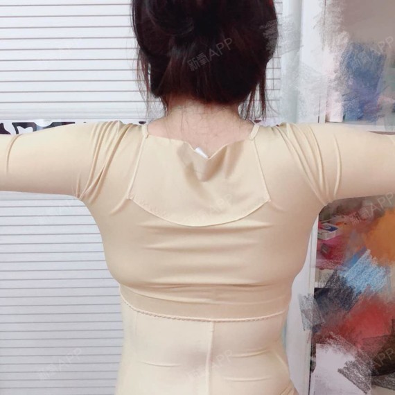 简直不敢相信,医生建议我可以活动一下手臂,我想说我的手真的是没有