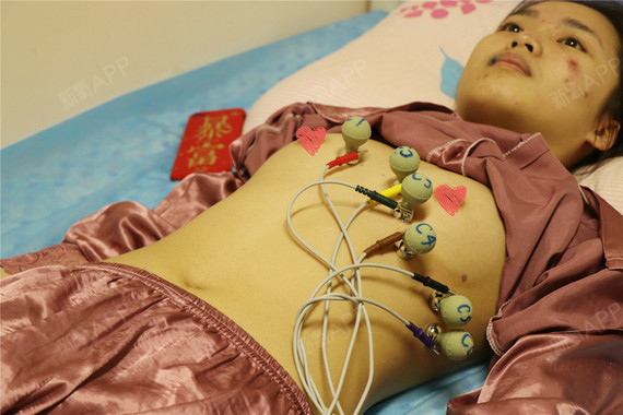 新氧- angelia_ | 胸部 | 隆胸 | 假体隆胸 | 自体脂肪隆胸 | 术后当